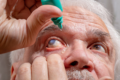Glaucoma Management